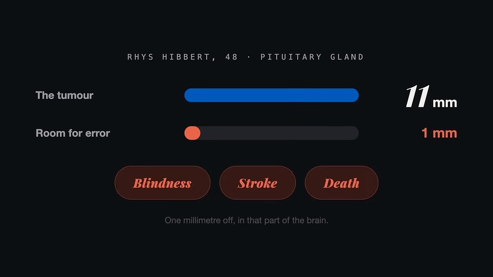 Surgeons Used AI in Real Time to Remove a Brain Tumour thumbnail